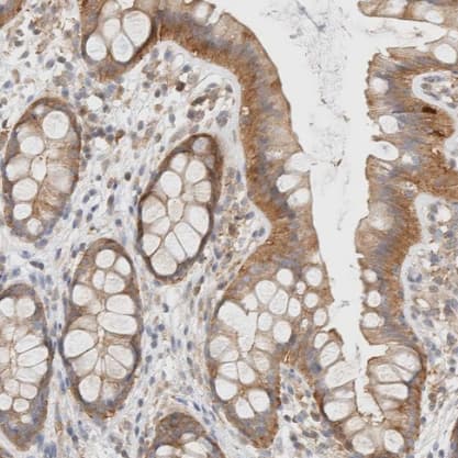 Immunohistochemistry-Paraffin: TBC1D8B Antibody [NBP1-82191] -Staining of human rectum shows strong cytoplasmic positivity in glandular cells.