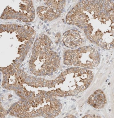 Immunohistochemistry-Paraffin: TBC1D8B Antibody [NBP1-82191] -Staining of human prostate shows strong cytoplasmic positivity in glandular cells.