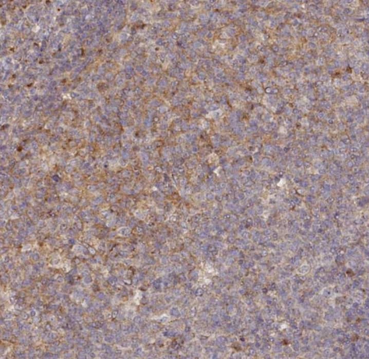  Staining of human tonsil shows weak membranous and cytoplasmic positivity in germinal center cells.