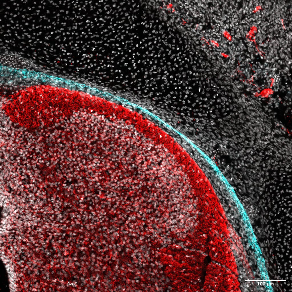 Western Blot: Claudin-11 Antibody [NBP1-82470] - Comparison of expression changes between young & old MRC-5 & HFF fibroblasts measured with RNA-seq & Western Blots. (a) 8 genes commonly downregulated & (b) 8 genes commonly upregulated in both cell lines. (a, b) The colors of the bars indicate the measurement technique (blue: RNA-seq; red: Western Blots/protein expression). Solid colored bars represent MRC-5 while shaded boxes represent HFF cells. The height of the bars corresponds to the logarithmic fold-change (FC) of expression between the first & the last PD investigated here (RNA-seq: log 2 RPKM FC; protein: log 2 expression ratio). Error bars indicate standard deviation from the mean. Changes statistically different comparing young & old PD (RNA-seq: DESeq; rRT-PCR/Protein: Student's t-test; n = 3) are indicated with an asterix: ∗p White: DAPIRed: TUBB3Cyan: Claudin 11Image from a verified customer review.