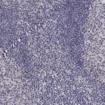 Immunohistochemistry-Paraffin: SIX6 Antibody [NBP1-82478] -Staining of human tonsil shows negative nuclear positivity in non-germinal center cells as expected.