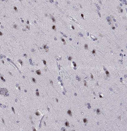 Immunohistochemistry-Paraffin: SIX6 Antibody [NBP1-82478] -Staining of human cerebral cortex shows strong nuclear positivity in neurons.