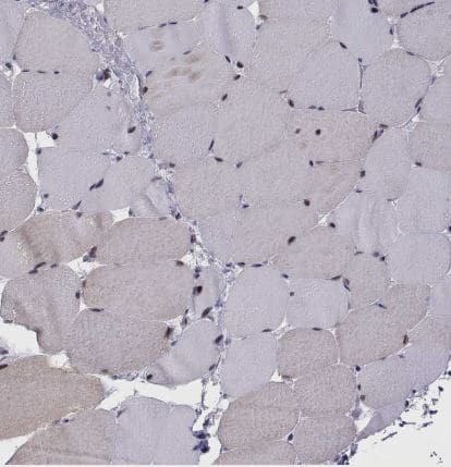 Immunohistochemistry-Paraffin: SIX6 Antibody [NBP1-82478] - Staining of human skeletal muscle shows strong nuclear positivity in myocytes.