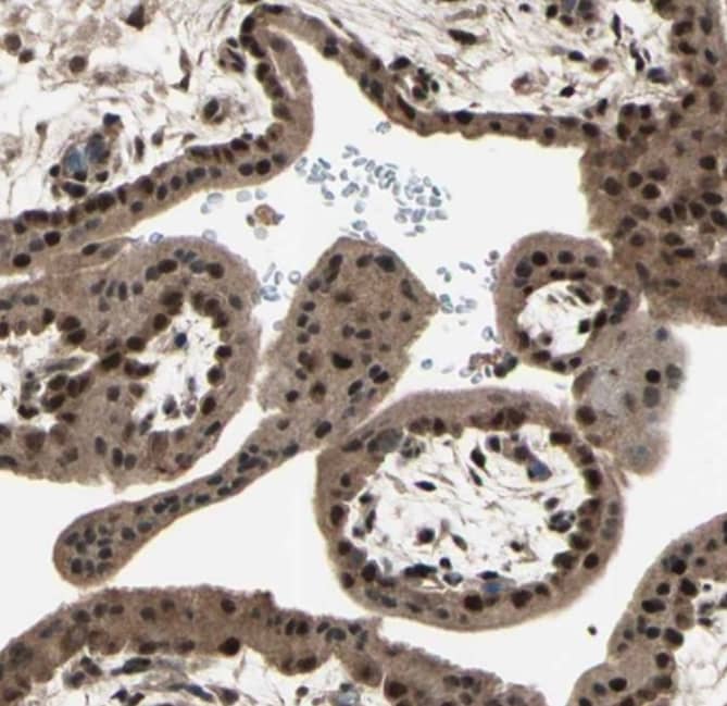 Staining of human placenta shows strong nuclear-cytoplasmic positivity in trophoblastic cells.