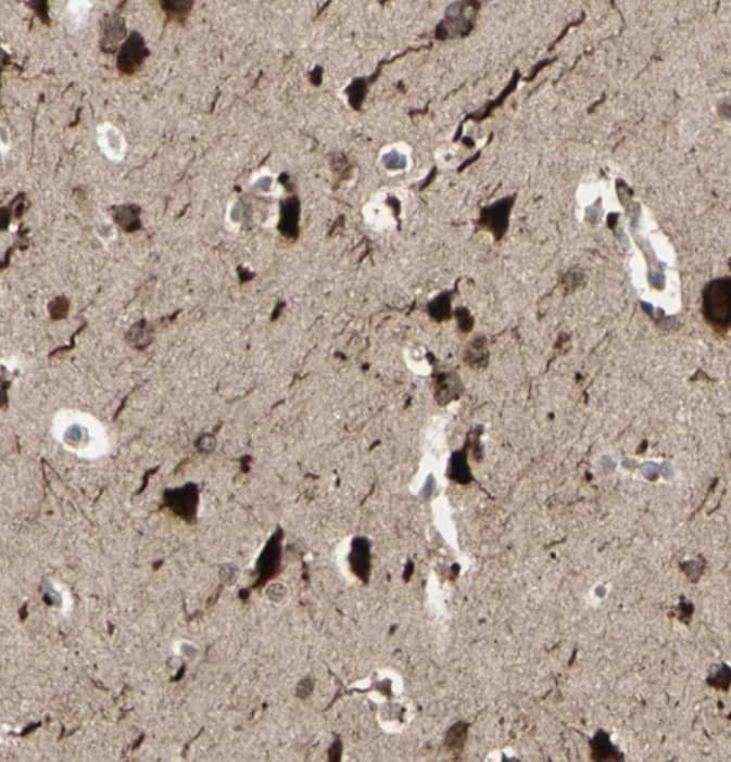 Staining of human cerebral cortex shows strong nuclear/nuclear membranous-cytoplasmic positivity in neurons.