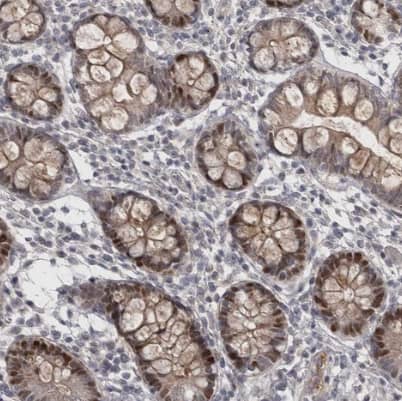 Immunohistochemistry-Paraffin ZNF277 Antibody - BSA Free