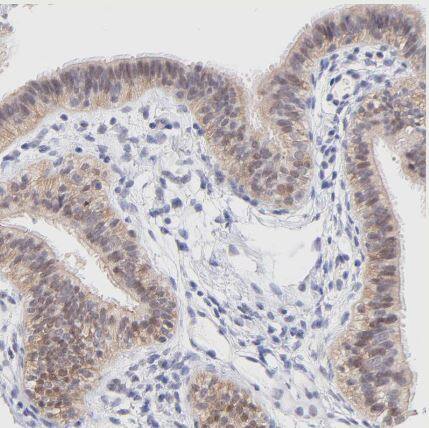Immunohistochemistry-Paraffin: PBDC1 Antibody [NBP1-82657] - Staining of human Fallopian tube shows weak cytoplasmic positivity in glandular cells.