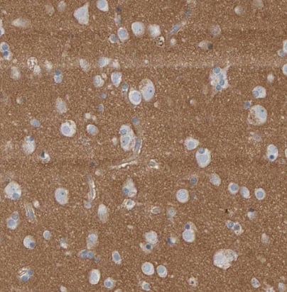 Immunohistochemistry-Paraffin Fyn Antibody