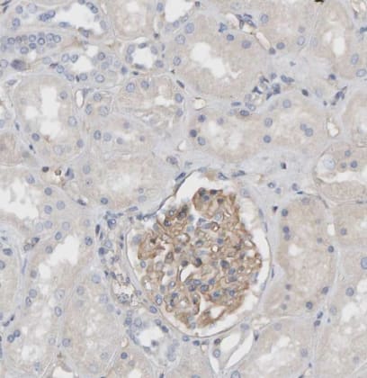 Immunohistochemistry-Paraffin Fyn Antibody