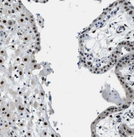 Immunohistochemistry-Paraffin: SSB Antibody [NBP1-82851] - Staining of human placenta shows strong nuclear positivity in trophoblastic cells and decidual cells.