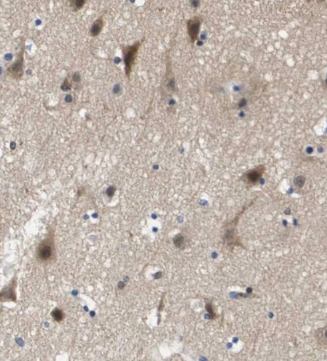 Immunohistochemistry-Paraffin Kv7.5 Antibody - BSA Free
