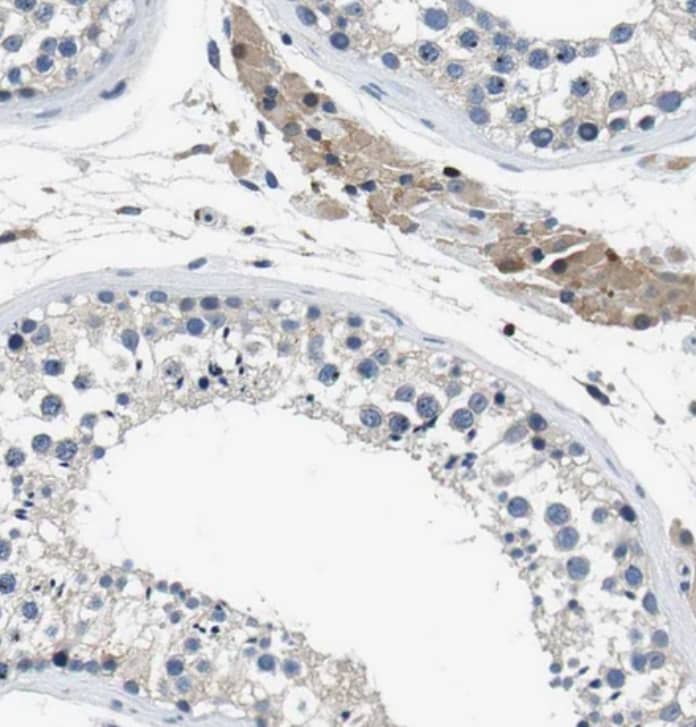 Staining of human testis shows weak cytoplasmic positivity in Leydig cells.