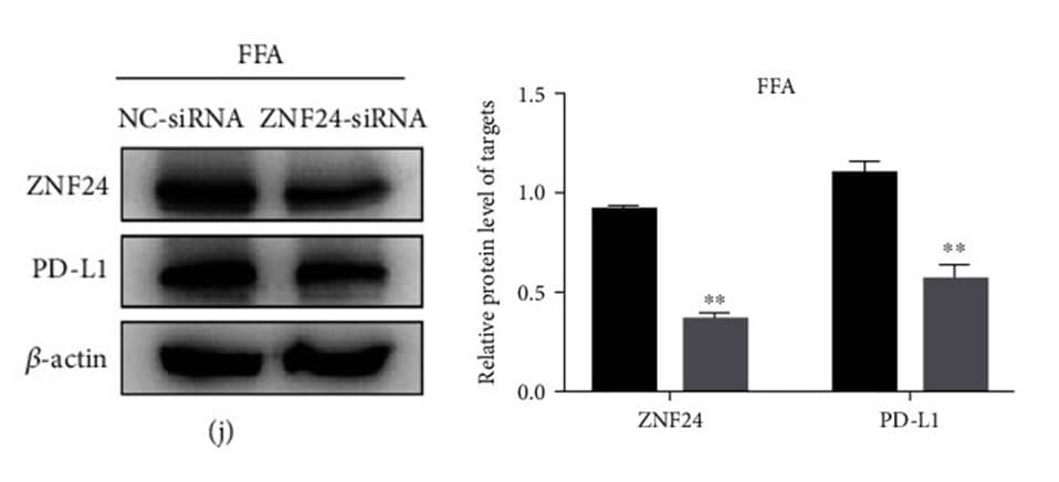 <b>Genetic Strategies Validation. </b>Knockdown: ZNF24 Antibody [NBP1-82866] - ZNF24 promoted PD-L1 expression through binding to its promoter in FFA-treated LO2 cells. ZNF24 and PD-L1 expression in LO2 cells pretreated with siRNA against ZNF24, followed by FFA treatment detected by western blot. ∗∗P < 0.01. PD-L1 expression was suppressed following the ZNF24 knockdown. Image collected and cropped by CiteAb from the following publication (//pubmed.ncbi.nlm.nih.gov/35615575/) licensed under a CC-BY license.