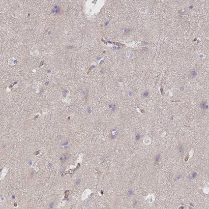 Immunohistochemistry-Paraffin: VPS18 Antibody [NBP1-82906] -Staining of human cerebral cortex shows no cytoplasmic positivity in neuronal cells as expected.