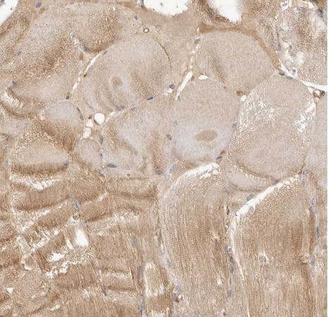 Staining of human skeletal muscle shows weak cytoplasmic positivity in myocytes. 