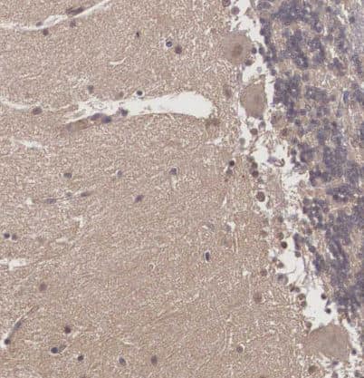 Immunohistochemistry-Paraffin Vasohibin Antibody - BSA Free