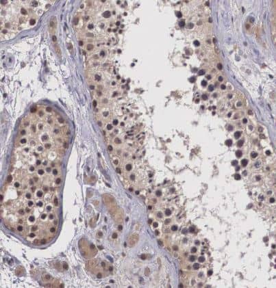 Immunohistochemistry-Paraffin Vasohibin Antibody - BSA Free