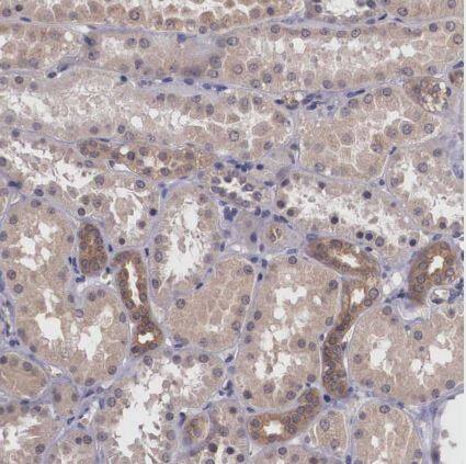 Immunohistochemistry-Paraffin Vasohibin Antibody - BSA Free