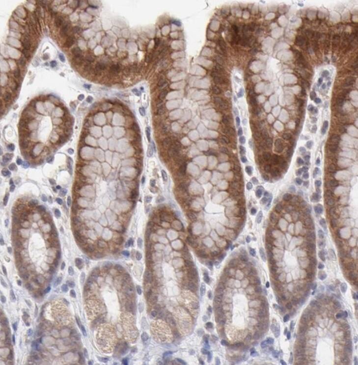 Immunohistochemistry-Paraffin OAS1 Antibody - BSA Free