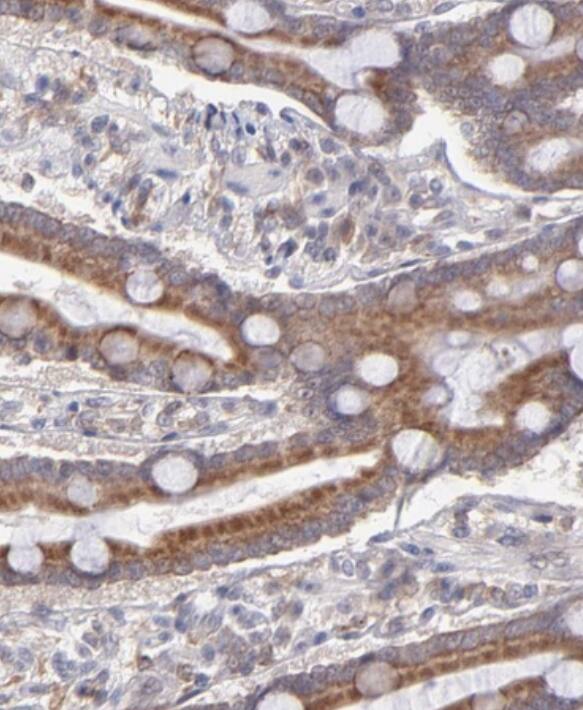 Immunohistochemistry-Paraffin OAS1 Antibody - BSA Free