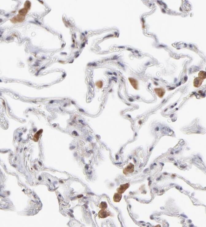 Immunohistochemistry-Paraffin OAS1 Antibody - BSA Free