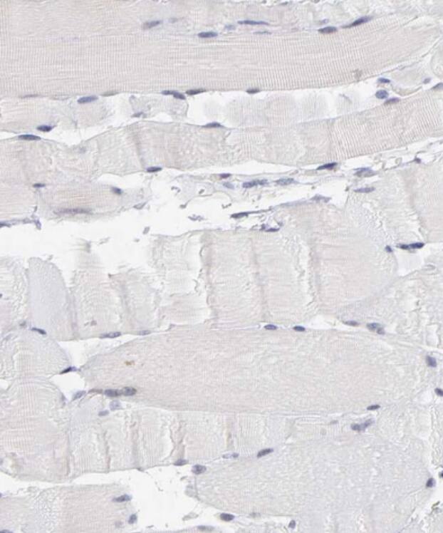 Staining of human skeletal muscle shows no positivity in myocytes as expected.