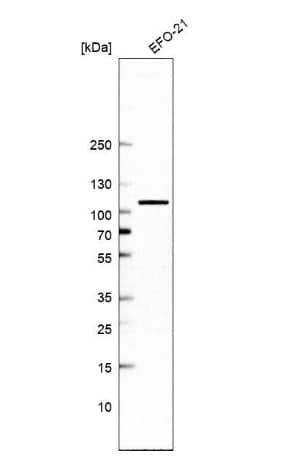 Western Blot: TBCK Antibody [NBP1-83166] -Analysis in human cell line EFO-21.