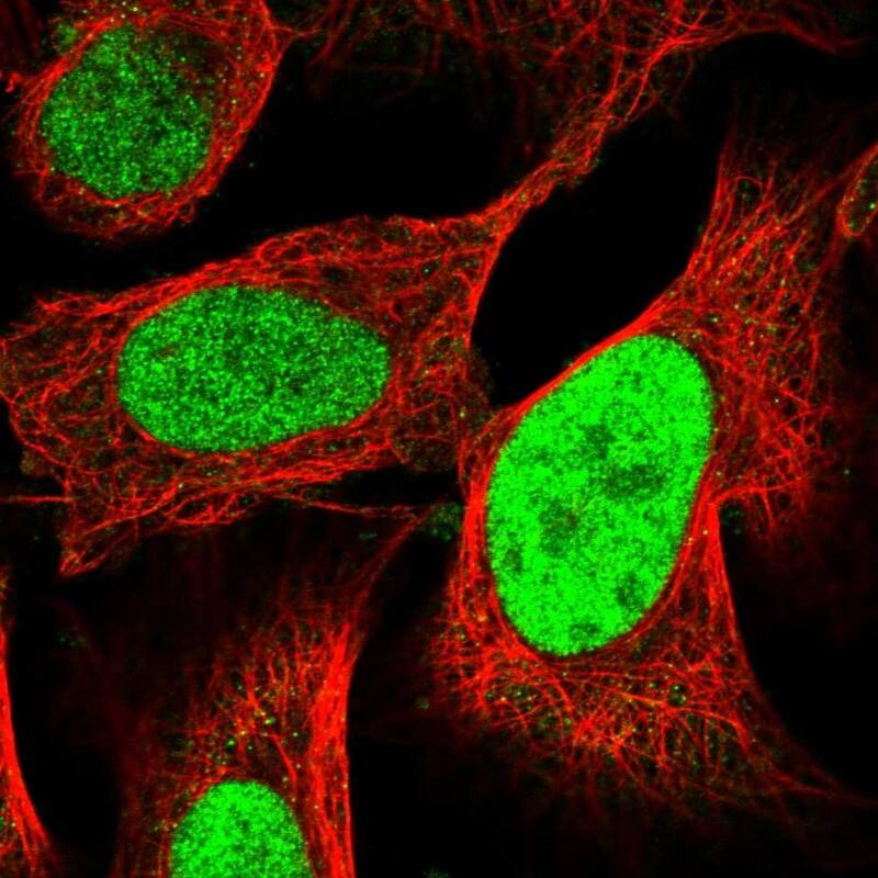 Immunohistochemistry: HCA59 Antibody [NBP1-83169] - Staining of human cell line U-2 OS shows localization to the nucleoplasm.