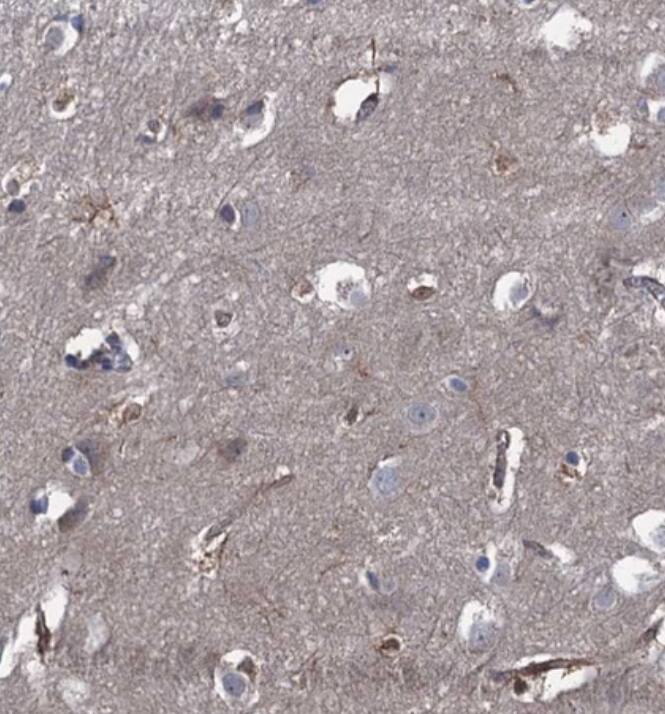  Staining of human cerebral cortex shows weak positivity in neuropil.