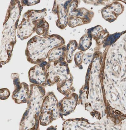 Immunohistochemistry-Paraffin: HAI-2/SPINT2 Antibody [NBP1-83299] -Staining of human placenta shows strong membranous and cytoplasmic positivity in trophoblastic cells.