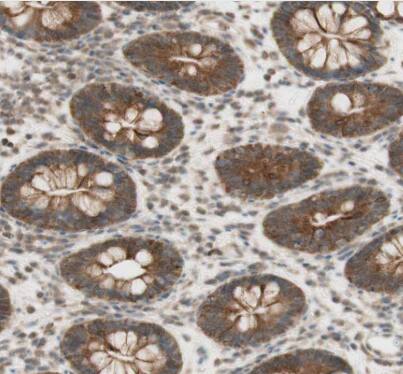 Immunohistochemistry-Paraffin: HAI-2/SPINT2 Antibody [NBP1-83299] - Staining of human rectum shows strong membranous and cytoplasmic positivity in glandular cells.