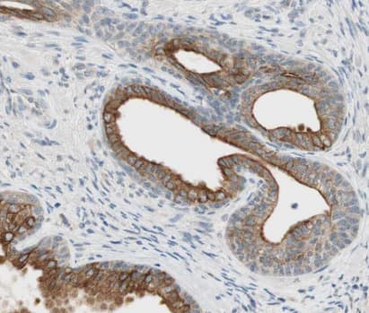 Immunohistochemistry-Paraffin: HAI-2/SPINT2 Antibody [NBP1-83299] -Staining of human prostate shows strong membranous and cytoplasmic positivity in glandular cells.