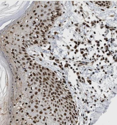 Immunohistochemistry-Paraffin RBM5 Antibody - BSA Free