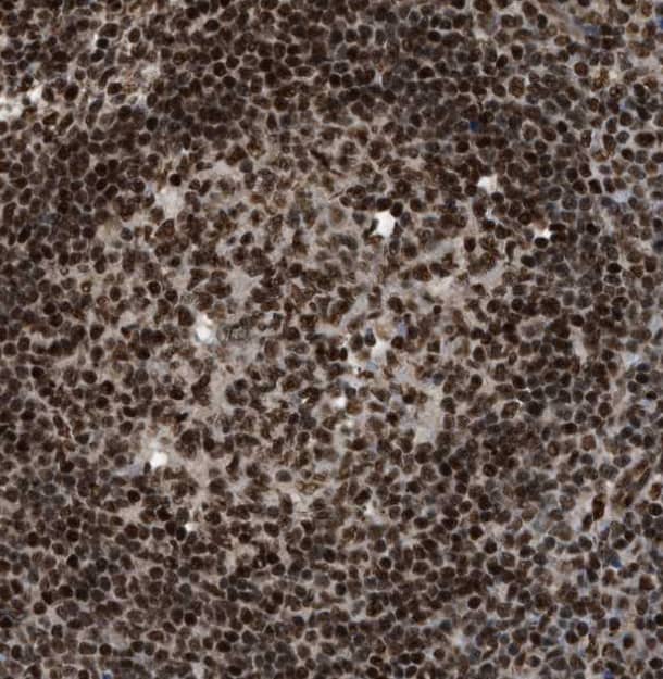 Immunohistochemistry-Paraffin RBM5 Antibody - BSA Free