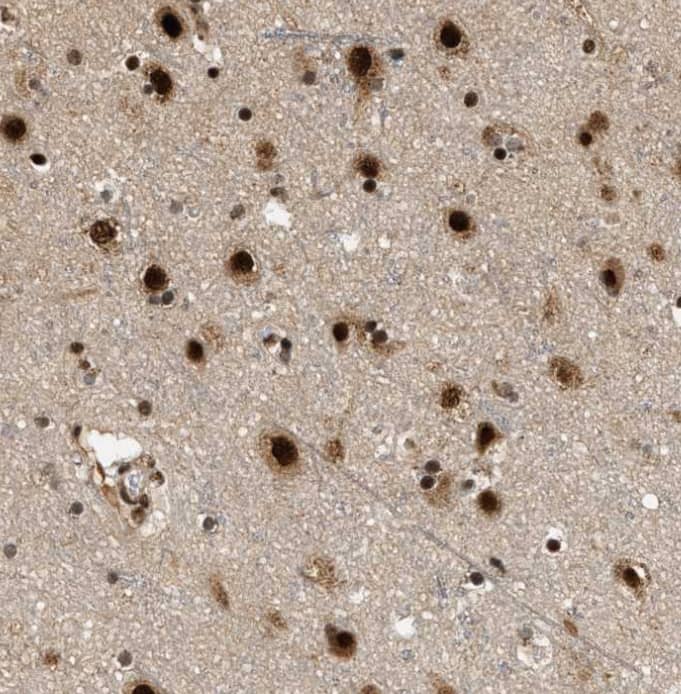 Staining of human cerebral cortex shows strong nuclear positivity in neuronal cells.