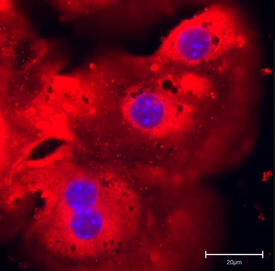 Immunocytochemistry/Immunofluorescence: Rabbit Polyclonal N-Acetylglucosaminyltransferase V/MGAT5 Antibody [NBP1-83354] - Primary mouse hepatocytes stained with N-Acetylglucosaminyltransferase V/MGAT5. Image from a verified customer review.