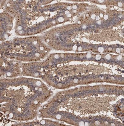 Immunohistochemistry-Paraffin: N-Acetylglucosaminyltransferase V/MGAT5 Antibody [NBP1-83354] - Staining of human small intestine shows strong cytoplasmic granular positivity in glandular cells.