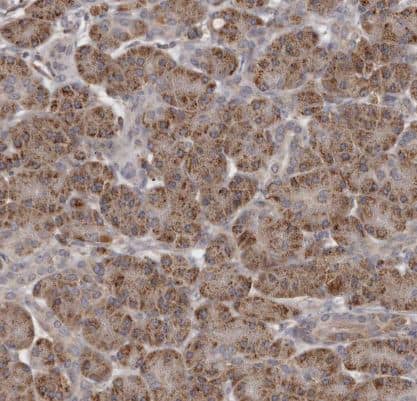 Immunohistochemistry-Paraffin: N-Acetylglucosaminyltransferase V/MGAT5 Antibody [NBP1-83354] - Staining of human pancreas shows strong cytoplasmic granular positivity in exocrine glandular cells.