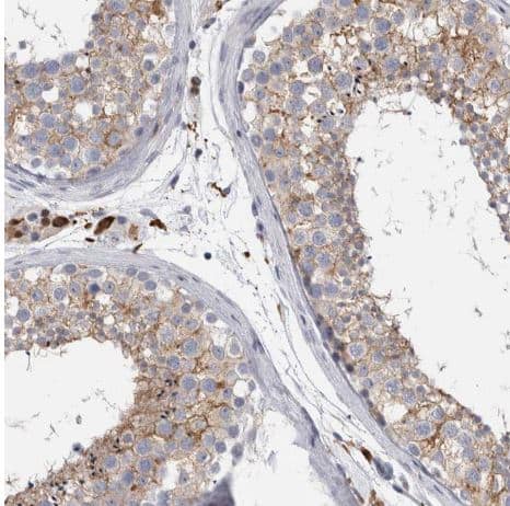 Immunohistochemistry-Paraffin: SLC20A2 Antibody [NBP1-83360] - Staining of human testis shows moderate membranous positivity in cells in seminiferous ducts.