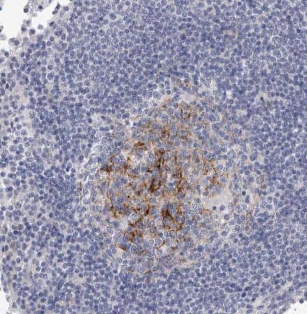 Immunohistochemistry-Paraffin: SLC20A2 Antibody [NBP1-83360] - Staining of human lymph node shows strong membranous positivity in germinal center cells.