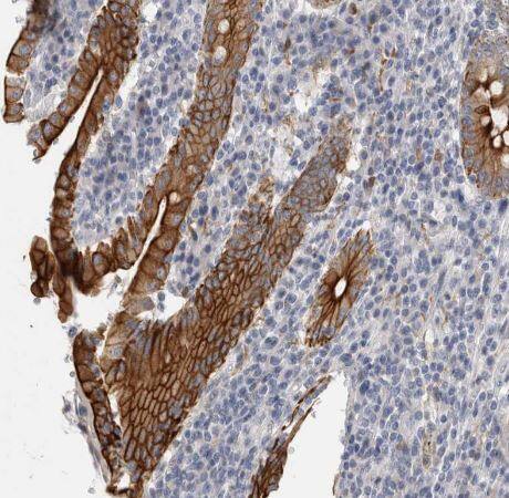 Immunohistochemistry-Paraffin: SLC20A2 Antibody [NBP1-83360] - Staining of human duodenum shows strong membranous positivity in glandular cells.