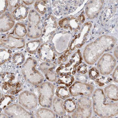 Immunohistochemistry-Paraffin: SLC20A2 Antibody [NBP1-83360] - Staining of human kidney shows moderate membranous positivity in cells in tubules.