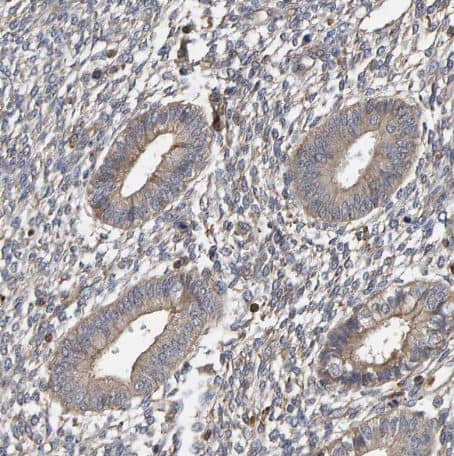 Immunohistochemistry-Paraffin: PLA2G3 Antibody [NBP1-83367] - Staining of human endometrium shows weak membranous and cytoplasmic positivity in glandular cells as expected. 