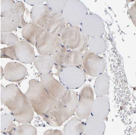 Immunohistochemistry-Paraffin: PLA2G3 Antibody [NBP1-83367] - Staining of human skeletal muscle shows no membranous and cytoplasmic positivity in myocytes as expected.