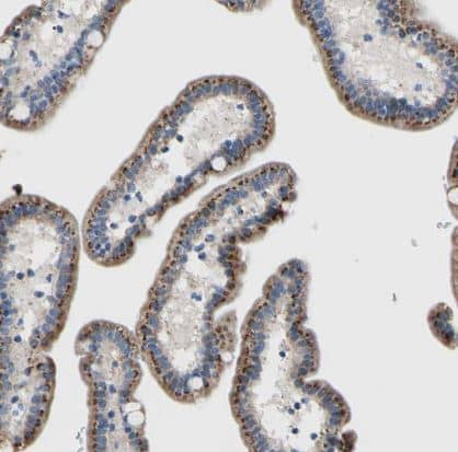 Immunohistochemistry-Paraffin: GALNT2 Antibody [NBP1-83394] - Staining of human small intestine shows strong cytoplasm granular positivity in glandular cells.