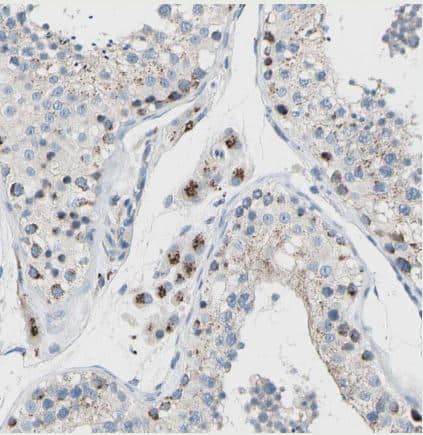 Immunohistochemistry-Paraffin: GALNT2 Antibody [NBP1-83394] - Staining of human testis shows strong cytoplasm granular positivity in Leydig cells.