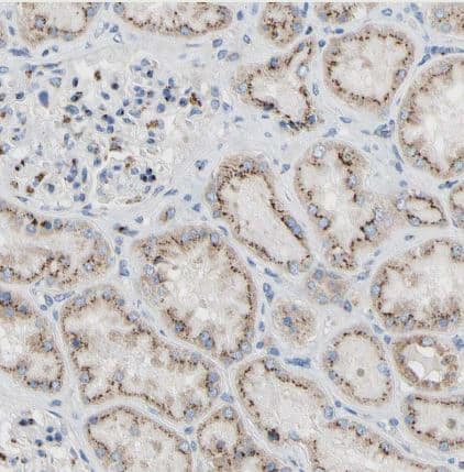 Immunohistochemistry-Paraffin: GALNT2 Antibody [NBP1-83394] - Staining of human kidney shows strong cytoplasm granular positivity in cells in tubules.