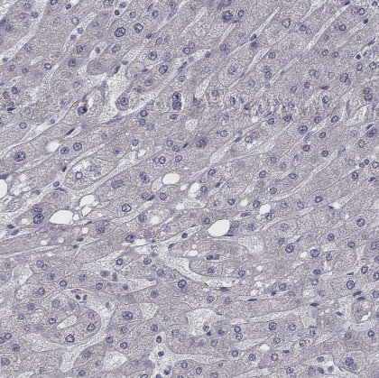 Immunohistochemistry-Paraffin: CHST8 Antibody [NBP1-83396] -Staining of human liver shows no positivity in hepatocytes as expected.