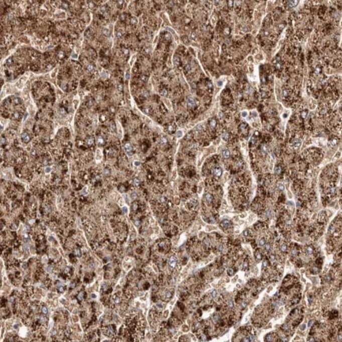 Staining of human liver shows strong cytoplasmic granular positivity in hepatocytes.