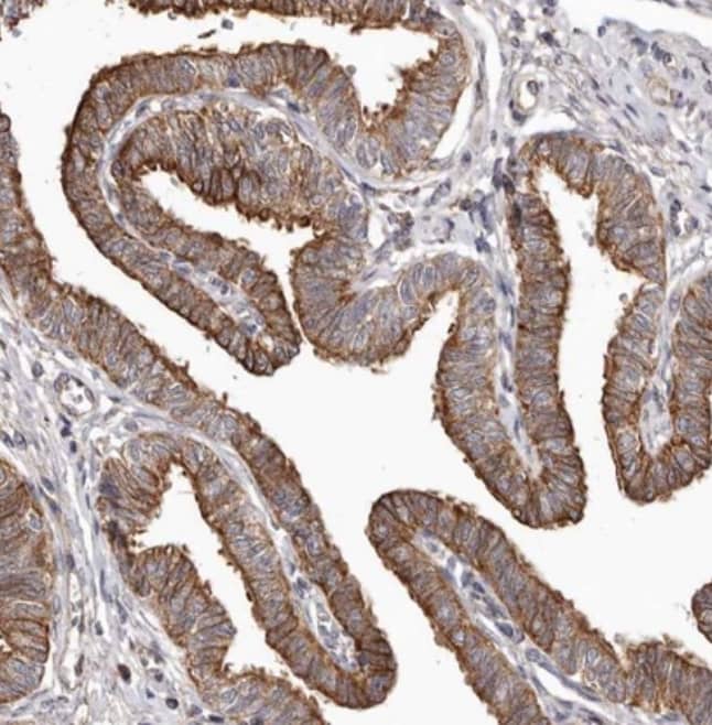 Staining of human fallopian tube shows strong cytoplasmic and membranous positivity in glandular cells.